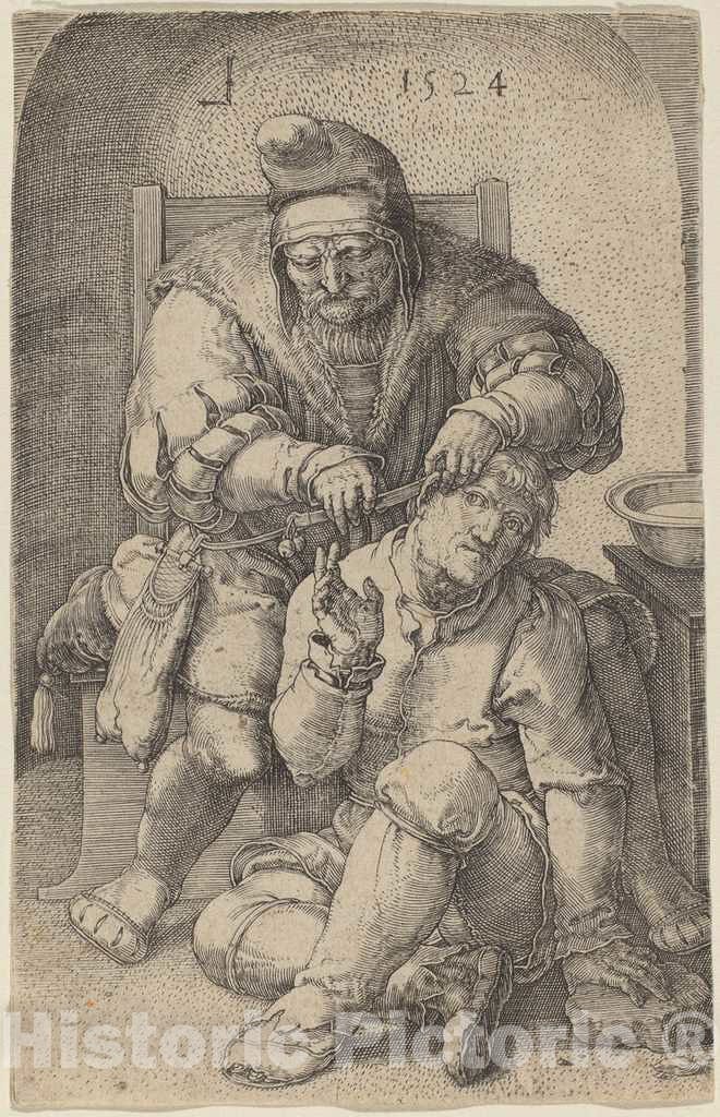 Art Print : Lucas Van Leyden, The Surgeon, 1524 - Vintage Wall Art