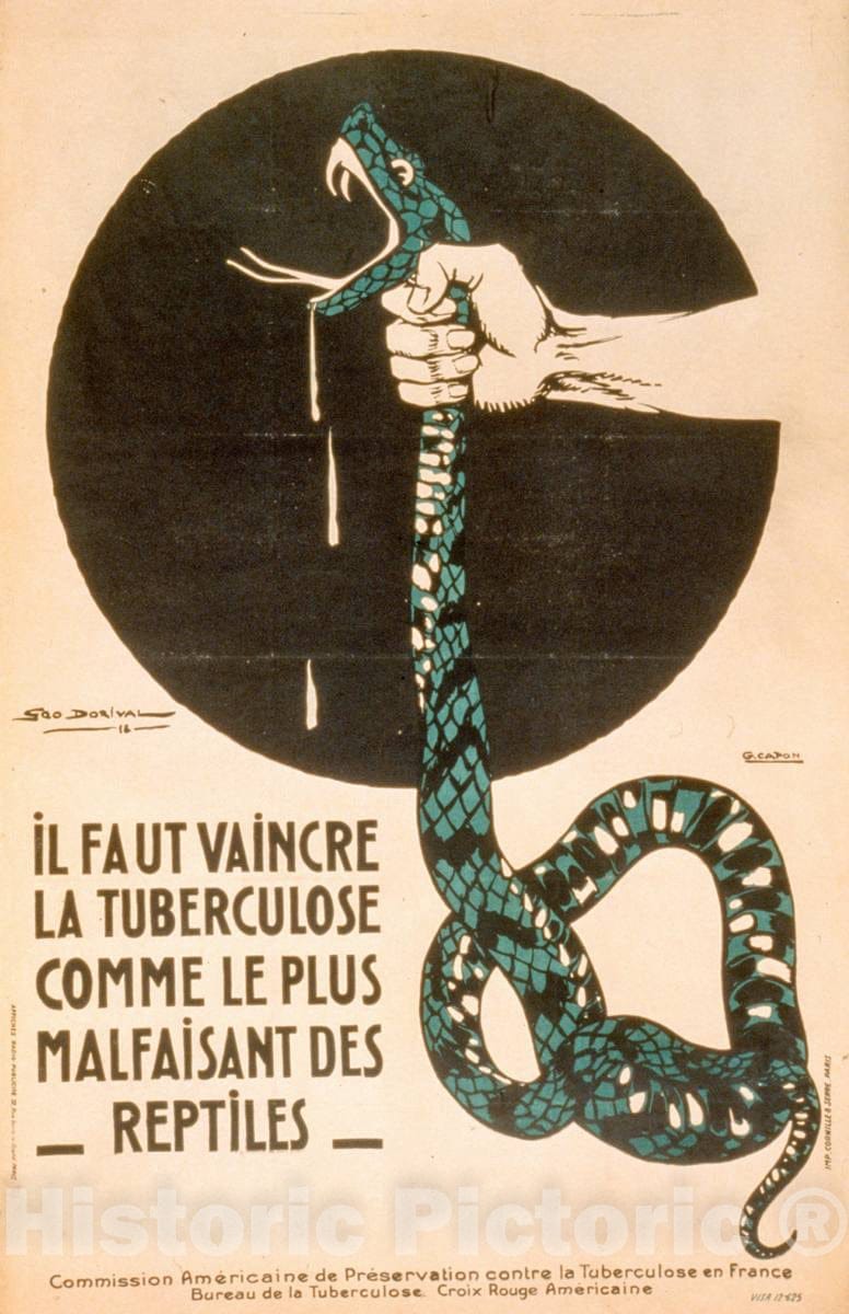 Vintage Poster -  Il faut vaincre la tuberculose Comme le Plus malfaisant des Reptiles, Historic Wall Art