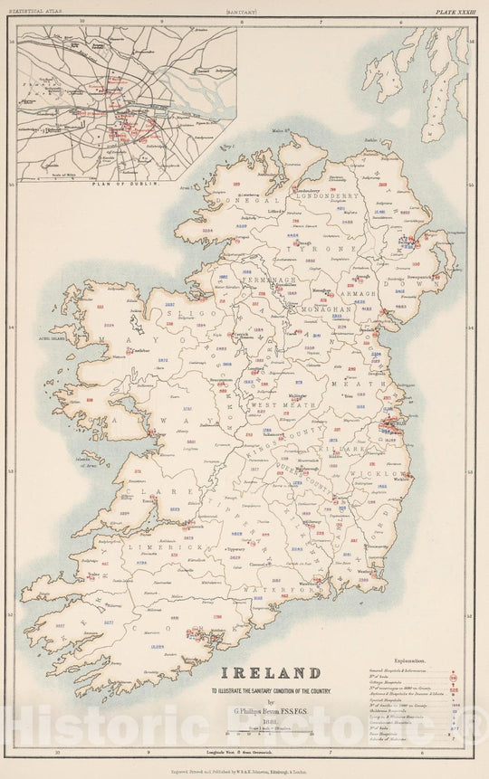 Historic Map : Statistical Atlas - 1881 Ireland to Illustrate the Sanitary Condition of the Country. - Vintage Wall Art