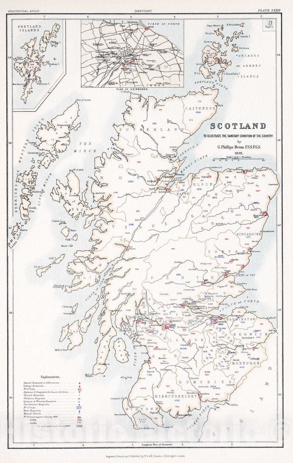 Historic Map : Statistical Atlas - 1881 Scotland to Illustrate the Sanitary Condition of the Country. - Vintage Wall Art